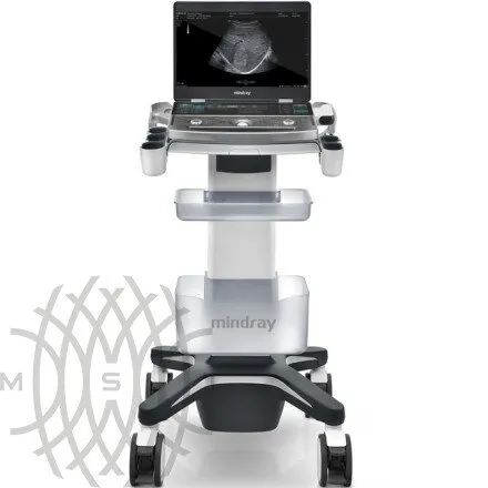 УЗИ аппарат Mindray MX7 портативный