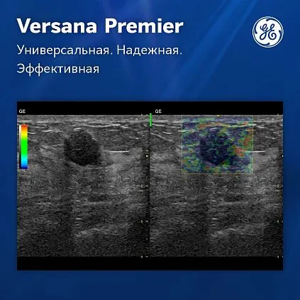 Клинические изображения Ультразвуковая система GE Versana Premier Black